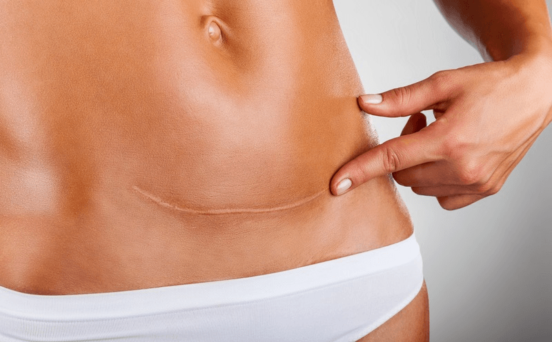 Post-Surgical Recovery & Wound Healing Hero Image